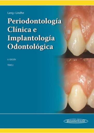 Periodontología clínica e implantología odontológica tomo 2