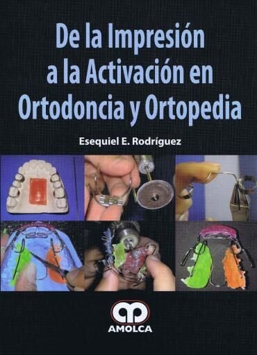 De la impresión a la activación en ortodoncia y ortopedia