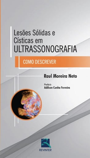Lesões sólidas e císticas em ultrassonografia
