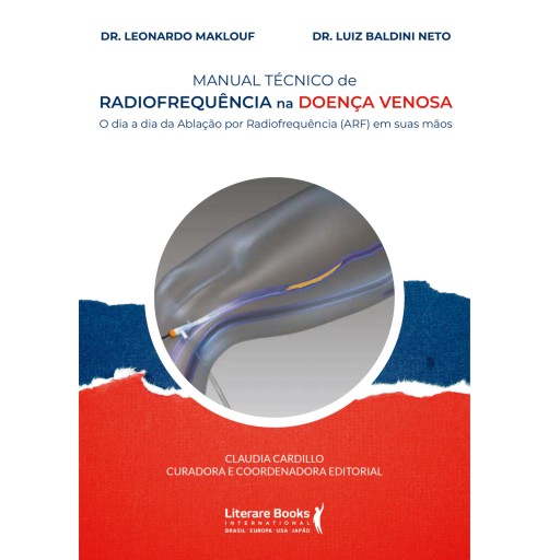 Manual técnico de radiofrequência na doença venosa