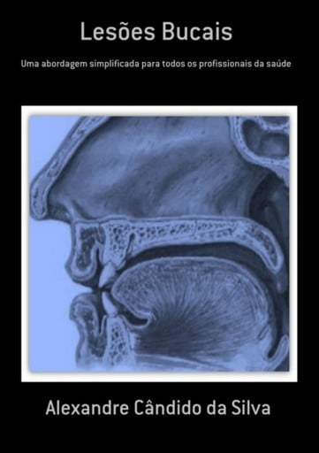 Lesões Bucais