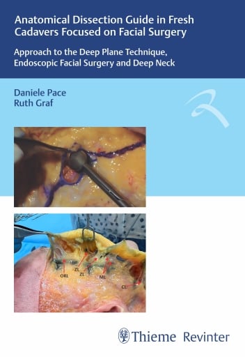 Anatomical Dissection Guide in Fresh Cadavers Focused on Facial Surgery