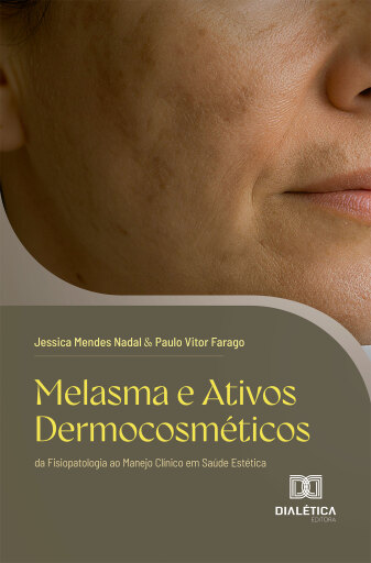 Melasma e Ativos Dermocosméticos