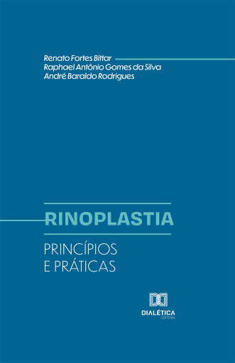 Rinoplastia