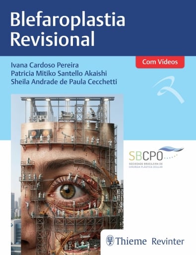 Blefaroplastia Revisional