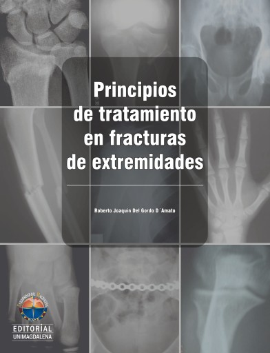 Principios de tratamiento en fracturas de extremidades