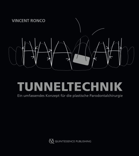 Tunneltechnik