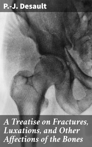 A Treatise on Fractures, Luxations, and Other Affections of the Bones