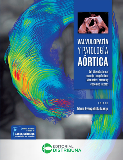 Valvulopatía y patología aórtica