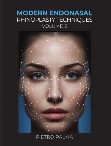 Modern Endonasal Rhinoplasty Techniques – Volume 2