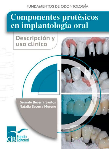 Componentes protésicos en implantología oral