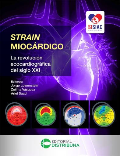 Strain Miocárdico