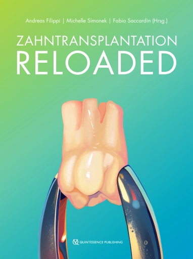 Zahntransplantation Reloaded