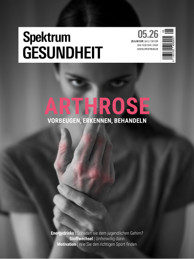 Portada del libro «Spektrum Gesundheit 5/2026 - Arthrose»