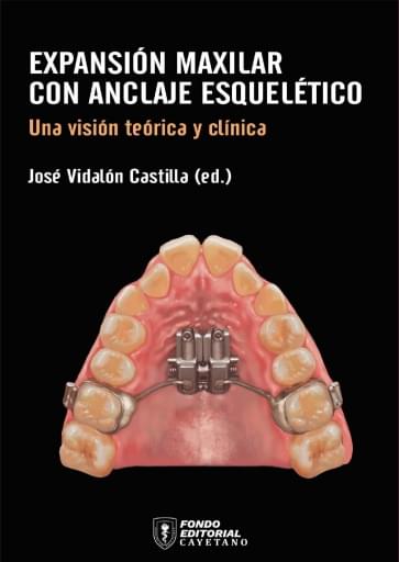 Expansión maxilar con anclaje esquelético. Una visión teórica y clínica