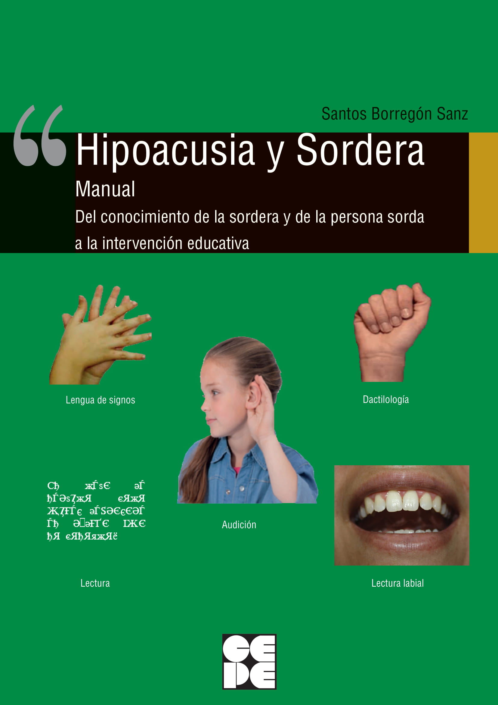 Hipoacusia y Sordera. Manual. Del conocimiento de la sordera y de la persona so