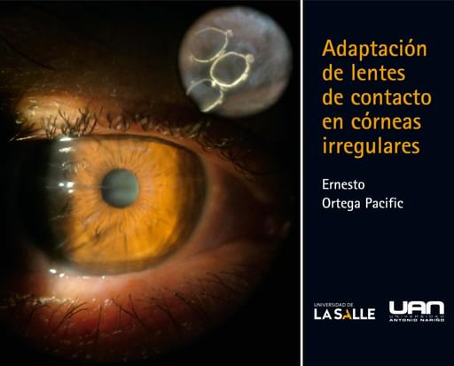 Adaptación de lentes de contacto en córneas irregulares