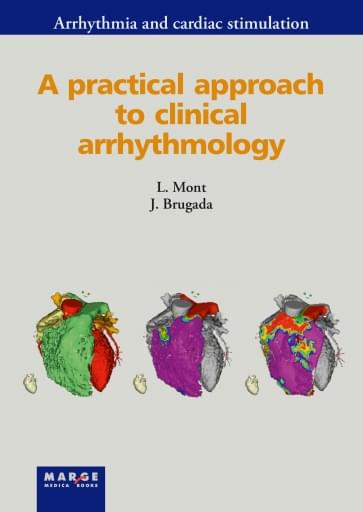 A practical approach to clinical arrhythmology