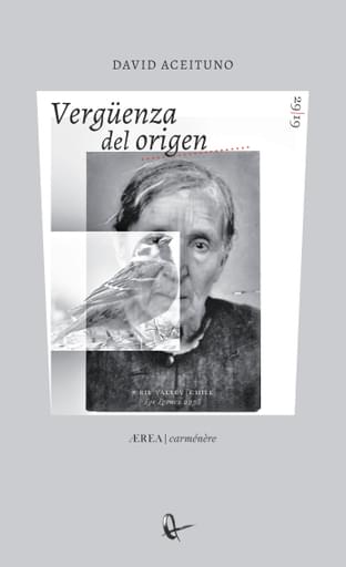 Vergüenza del origen