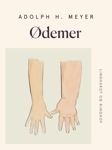 Ødemer